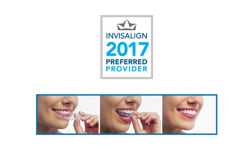 Guelph Orthodontics Dr. Fiore Braces and Invisalign for Guelph